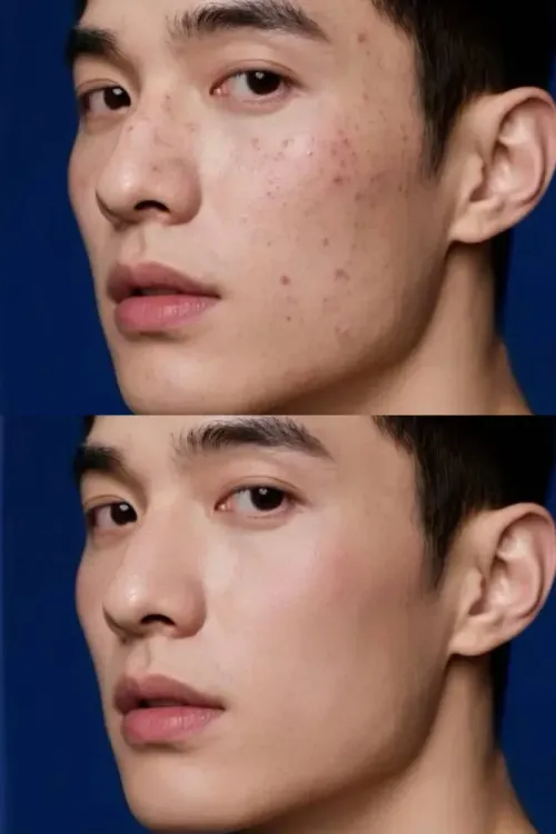 online face smooth